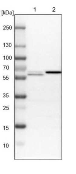 EXOC7 Antibody, Novus Biologicals 25ul | Buy Online | Novus Biologicals | Fisher Scientific