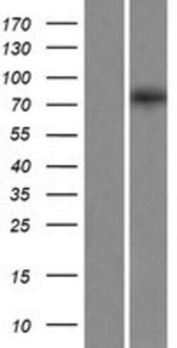 Novus Biologicals™ EXOC8 Overexpression Lysate