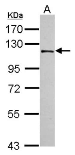 Exonuclease 1 Antibody, Novus Biologicals 0.1mL; Unlabeled:Antibodies,