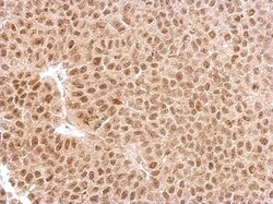 EXOSC3 Antibody, Novus Biologicals 0.1mL; Unlabeled:Antibodies, Polyclonal