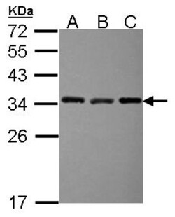 EXOSC3 Antibody, Novus Biologicals 0.1mL; Unlabeled:Antibodies, Polyclonal