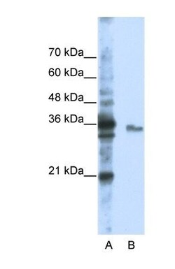 EXOSC3 Antibody, Novus Biologicals 0.05mg; Unlabeled:Antibodies