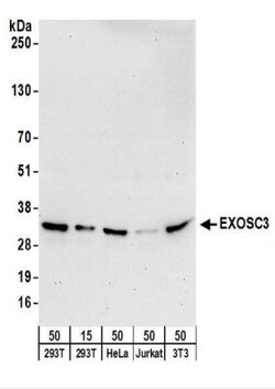 EXOSC3 Antibody, Novus Biologicals 0.1mg; Unlabeled:Antibodies