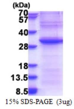 Novus Biologicals&trade;&nbsp;Recombinant Human Exosome component 4 His Protein