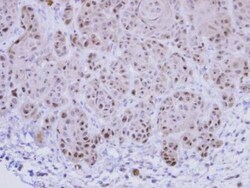 Exosome component 10 Antibody, Novus Biologicals 0.1mL; Unlabeled:Antibodies,