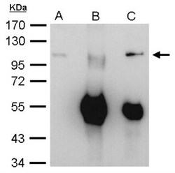 Exosome component 10 Antibody, Novus Biologicals 0.1mL; Unlabeled:Antibodies,
