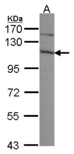 Exosome component 10 Antibody, Novus Biologicals 0.1mL; Unlabeled:Antibodies,