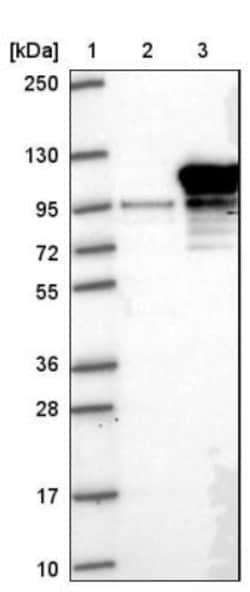 Exosome component 10 Antibody, Novus Biologicals 0.1mL; Unlabeled:Antibodies,