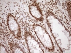 Exosome component 1 Antibody (OTI1H9), Novus Biologicals 0.1mL; Unlabeled:Antibodies,