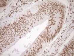 Exosome component 1 Antibody (OTI1H9), Novus Biologicals 0.1mL; Unlabeled:Antibodies,