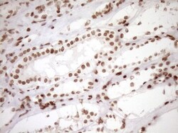 Exosome component 1 Antibody (OTI1H9), Novus Biologicals 0.1mL; Unlabeled:Antibodies,