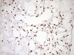 Exosome component 1 Antibody (OTI1H9), Novus Biologicals 0.1mL; Unlabeled:Antibodies,