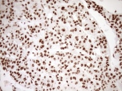 Exosome component 1 Antibody (OTI1H9), Novus Biologicals 0.1mL; Unlabeled:Antibodies,