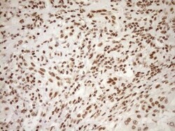 Exosome component 1 Antibody (OTI1H9), Novus Biologicals 0.1mL; Unlabeled:Antibodies,