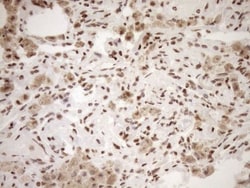 Exosome component 1 Antibody (OTI1H9), Novus Biologicals 0.1mL; Unlabeled:Antibodies,