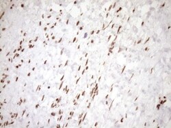 Exosome component 1 Antibody (OTI1H9), Novus Biologicals 0.1mL; Unlabeled:Antibodies,
