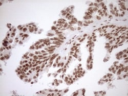 Exosome component 1 Antibody (OTI1H9), Novus Biologicals 0.1mL; Unlabeled:Antibodies,