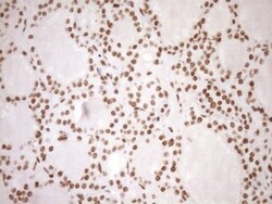 Exosome component 1 Antibody (OTI1H9), Novus Biologicals 0.1mL; Unlabeled:Antibodies,