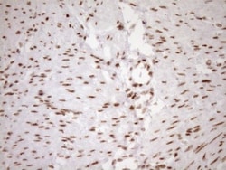 Exosome component 1 Antibody (OTI1H9), Novus Biologicals 0.1mL; Unlabeled:Antibodies,