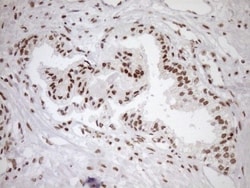 Exosome component 1 Antibody (OTI1H9), Novus Biologicals 0.1mL; Unlabeled:Antibodies,