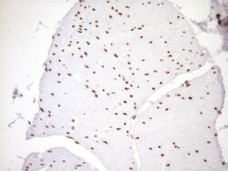 Exosome component 1 Antibody (OTI1H9), Novus Biologicals 0.1mL; Unlabeled:Antibodies,