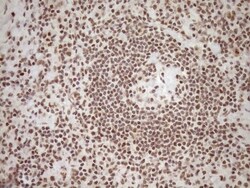 Exosome component 1 Antibody (OTI1H9), Novus Biologicals 0.1mL; Unlabeled:Antibodies,