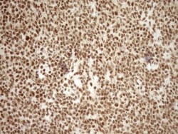 Exosome component 1 Antibody (OTI1H9), Novus Biologicals 0.1mL; Unlabeled:Antibodies,