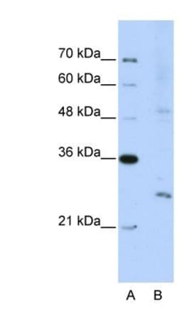 Exosome component 4 Antibody, Novus Biologicals 100&mu;L; Unlabeled:Antibodies,