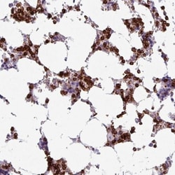 Exosome component 5 Antibody, Novus Biologicals 0.1mL; Unlabeled:Antibodies,