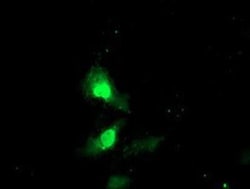 Exosome component 7 Antibody (OTI1G8), Novus Biologicals 0.1mL; Unlabeled:Antibodies,