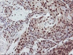 Exosome component 7 Antibody (OTI1G8), Novus Biologicals 0.1mL; Unlabeled:Antibodies,