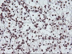 Exosome component 7 Antibody (OTI1G8), Novus Biologicals 0.1mL; Unlabeled:Antibodies,