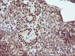 Exosome component 7 Antibody (OTI1G8), Novus Biologicals 0.1mL; Unlabeled:Antibodies,