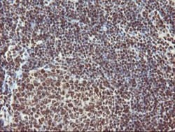 Exosome component 7 Antibody (OTI1G8), Novus Biologicals 0.1mL; Unlabeled:Antibodies,