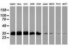 Exosome component 7 Antibody (OTI1G8), Novus Biologicals 0.1mL; Unlabeled:Antibodies,