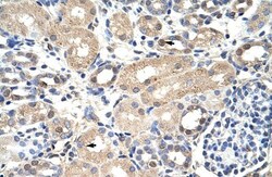 Exosome component 7 Antibody, Novus Biologicals 0.1mg; Unlabeled:Antibodies,