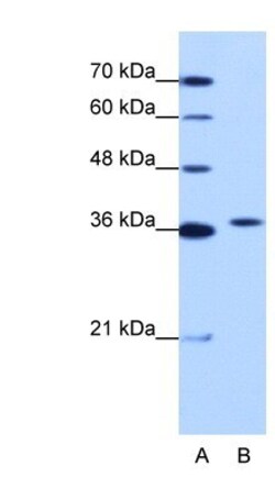 Exosome component 7 Antibody, Novus Biologicals 0.1mg; Unlabeled:Antibodies,