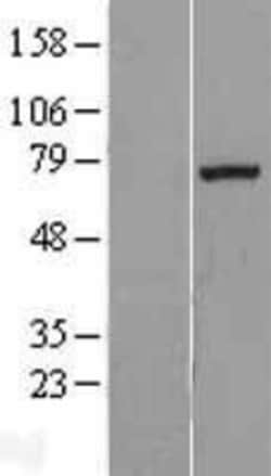 Novus Biologicals Exostosin-like 1/EXTL1 Overexpression Lysate 0.1mg | Buy Online | Novus Biologicals&trade; | Fisher Scientific