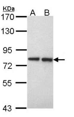 Ext2 Antibody, Novus Biologicals 0.1mL; Unlabeled:Antibodies, Polyclonal