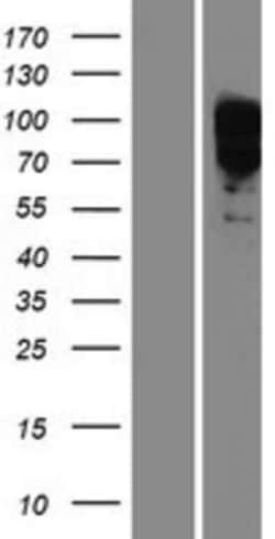 Novus Biologicals™ EYA1 Overexpression Lysate