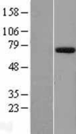 Novus Biologicals&trade;&nbsp;EYA1 Overexpression Lysate