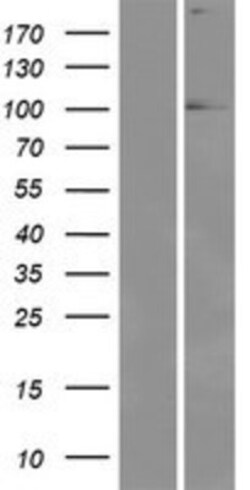 Novus Biologicals&trade;&nbsp;EYA1 Overexpression Lysate