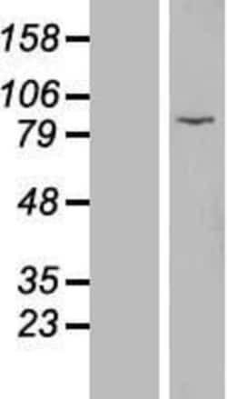 Novus Biologicals&trade;&nbsp;EZH1 Overexpression Lysate