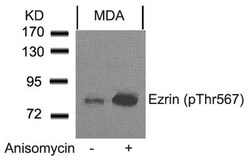 Ezrin, p Thr567 Antibody, Novus Biologicals:Antibodies:Primary Antibodies