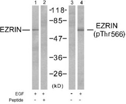 Ezrin, p Thr567 Antibody, Novus Biologicals:Antibodies:Primary Antibodies