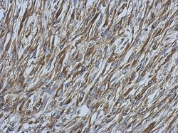 Ezrin Antibody, Novus Biologicals 0.1mL; Unlabeled:Antibodies, Polyclonal