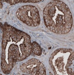 Ezrin Antibody (CL2360), Novus Biologicals 0.1mL; Unlabeled:Antibodies,