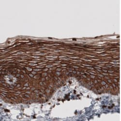 Ezrin Antibody (CL2378), Novus Biologicals:Antibodies:Primary Antibodies