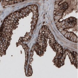 Ezrin Antibody (CL2378), Novus Biologicals:Antibodies:Primary Antibodies