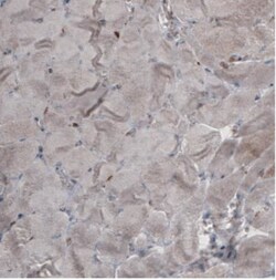 Ezrin Antibody (CL2378), Novus Biologicals:Antibodies:Primary Antibodies